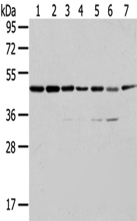 Rabbit Polyclonal Antibody to ERP44
