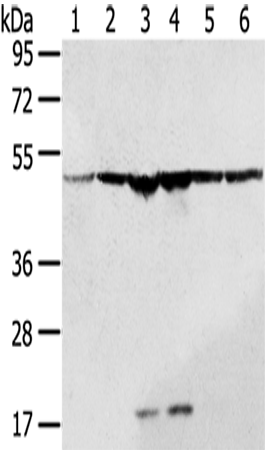 Rabbit Polyclonal Antibody to DDX39B