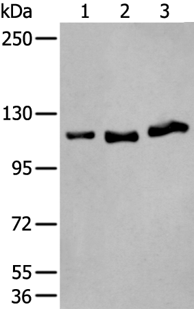 Rabbit Polyclonal Antibody to UBA1