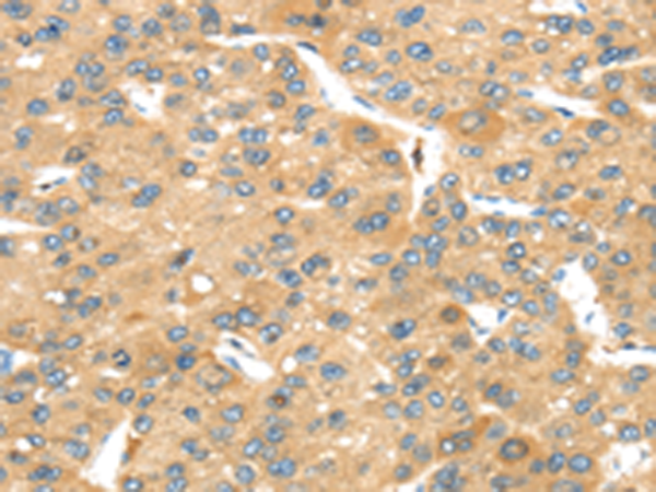 Rabbit Polyclonal Antibody to UBTD2