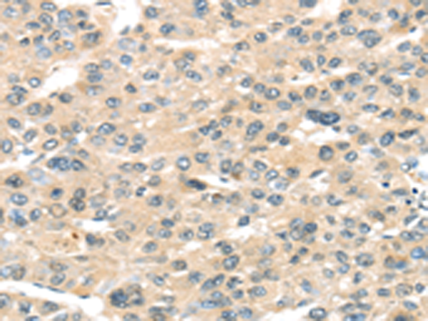 Rabbit Polyclonal Antibody to HAUS7