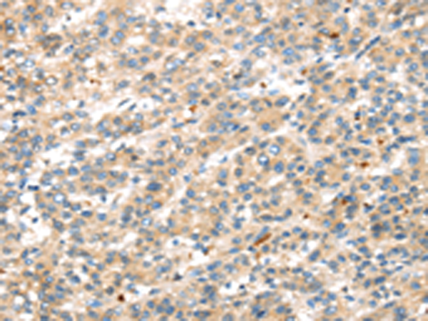Rabbit Polyclonal Antibody to DKK1