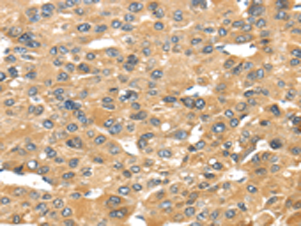 Rabbit Polyclonal Antibody to UCP1