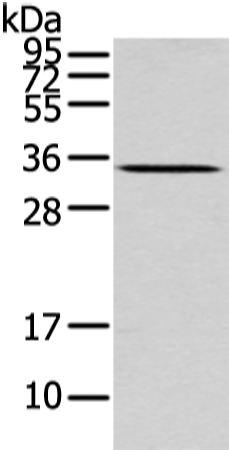 Rabbit Polyclonal Antibody to UCP2
