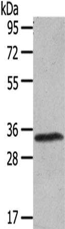 Rabbit Polyclonal Antibody to UCP3
