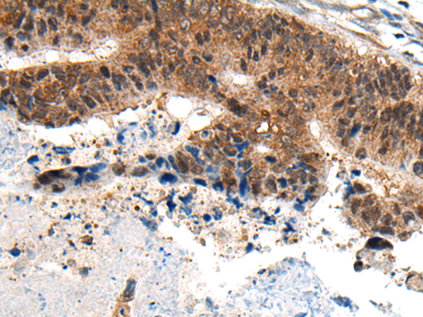 Rabbit Polyclonal Antibody to SLC25A27
