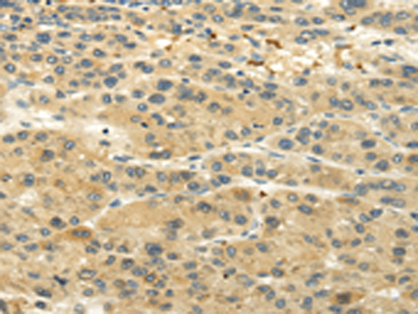 Rabbit Polyclonal Antibody to UGT1A6