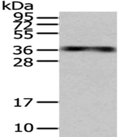 Rabbit Polyclonal Antibody to MSI1