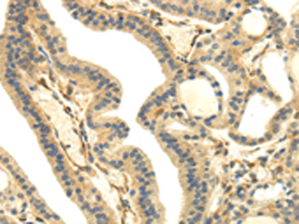 Rabbit Polyclonal Antibody to UHRF1BP1