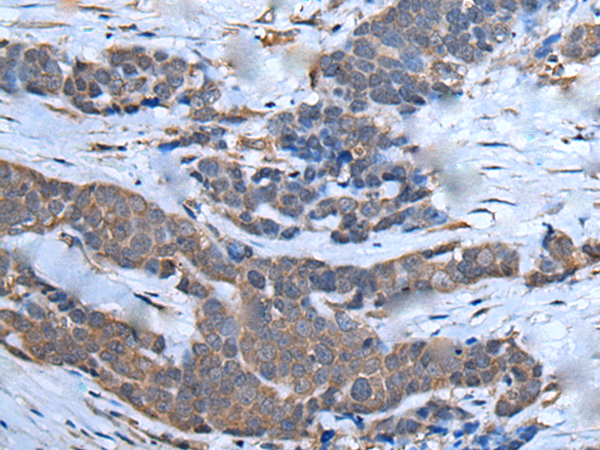 Rabbit Polyclonal Antibody to CHD3