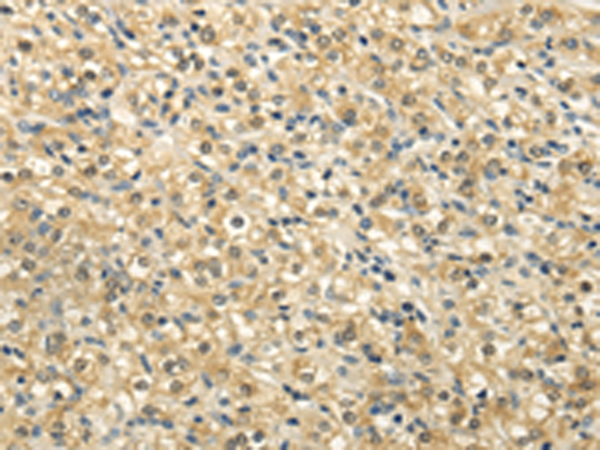 Rabbit Polyclonal Antibody to NSD1