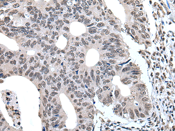 Rabbit Polyclonal Antibody to GTF2H1