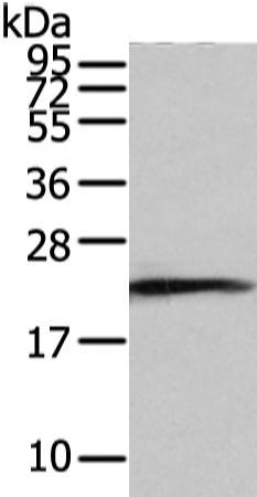 Rabbit Polyclonal Antibody to RAB2A