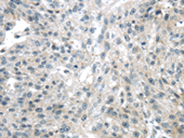Rabbit Polyclonal Antibody to ULBP1