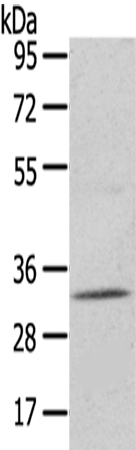 Rabbit Polyclonal Antibody to UPP2