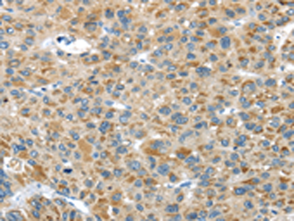 Rabbit Polyclonal Antibody to USP9X