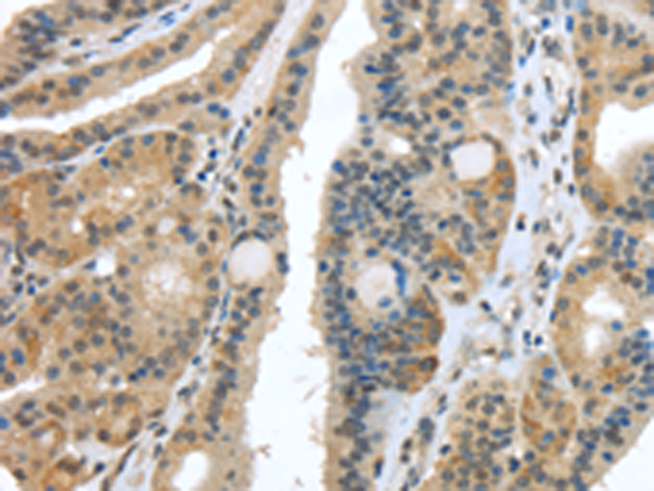 Rabbit Polyclonal Antibody to USP28