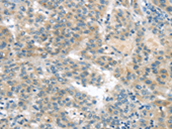 Rabbit Polyclonal Antibody to VAV2