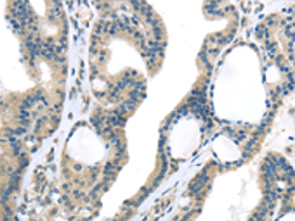 Rabbit Polyclonal Antibody to VGF