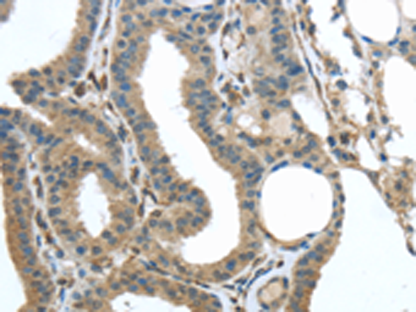 Rabbit Polyclonal Antibody to VSIG10