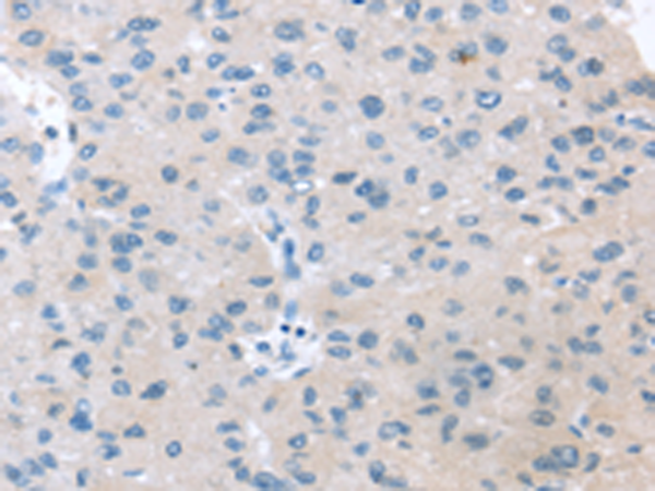 Rabbit Polyclonal Antibody to VPS4B