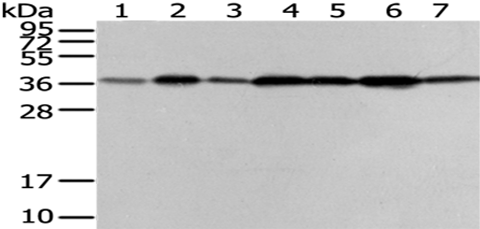 Rabbit Polyclonal Antibody to VPS26A