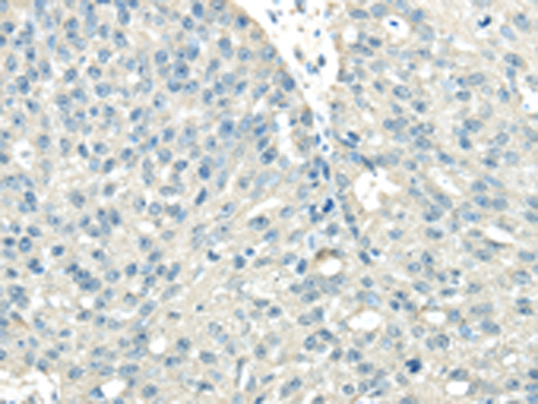Rabbit Polyclonal Antibody to VPS36