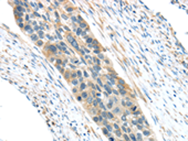 Rabbit Polyclonal Antibody to VWCE