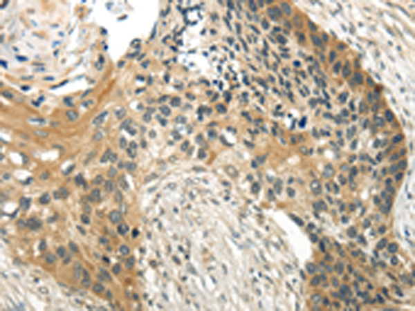 Rabbit Polyclonal Antibody to WDR36