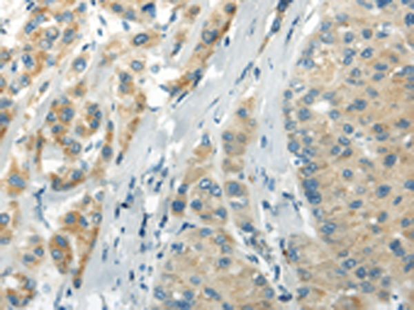 Rabbit Polyclonal Antibody to WFDC1