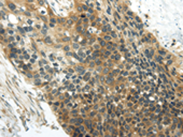 Rabbit Polyclonal Antibody to CCN4