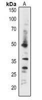 Rabbit Polyclonal Antibody to ABI5