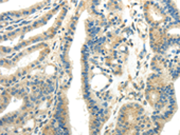 Rabbit Polyclonal Antibody to WNK1