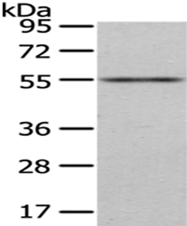 Rabbit Polyclonal Antibody to ENTPD1