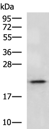 Rabbit Polyclonal Antibody to CD70