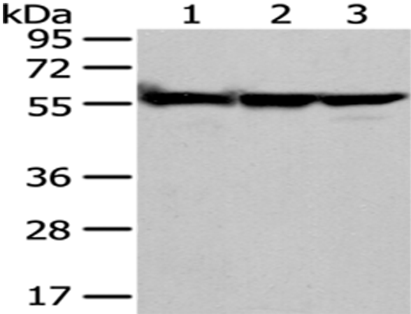 Rabbit Polyclonal Antibody to FYN