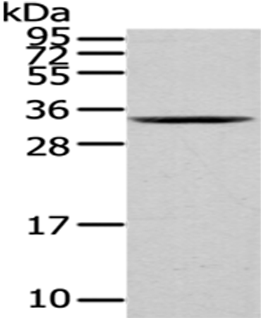 Rabbit Polyclonal Antibody to HNRNPC