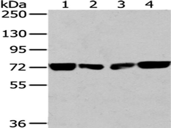 Rabbit Polyclonal Antibody to HNRNPM