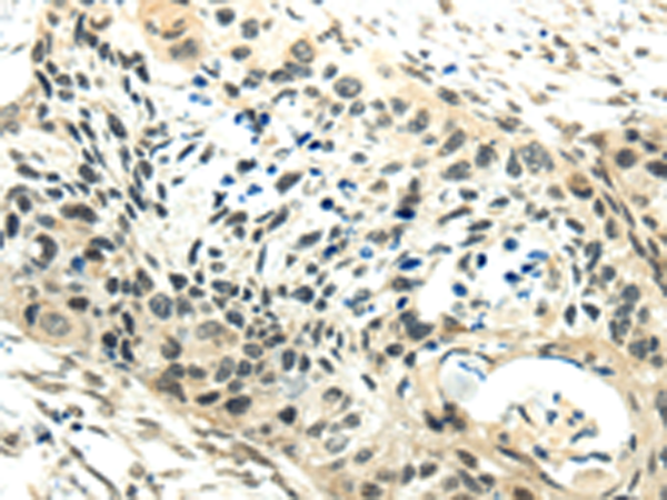 Rabbit Polyclonal Antibody to SYNCRIP