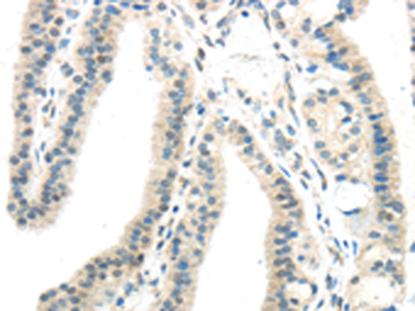 Rabbit Polyclonal Antibody to IL12A