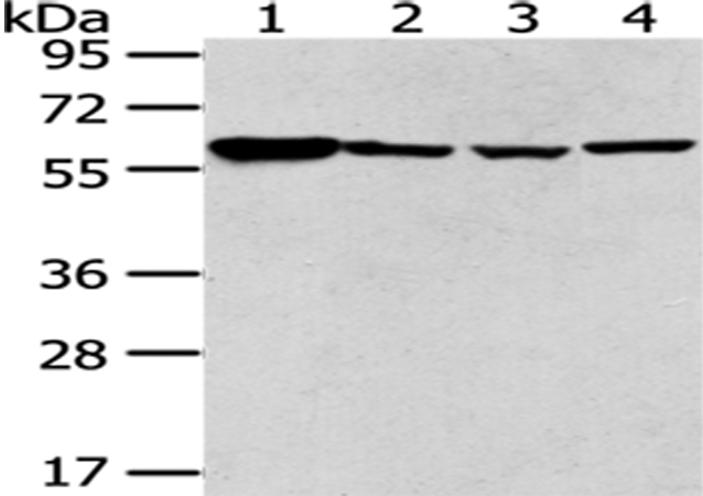 Rabbit Polyclonal Antibody to PKM