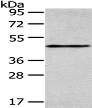 Rabbit Polyclonal Antibody to SMYD2