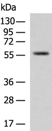 Rabbit Polyclonal Antibody to XIAP