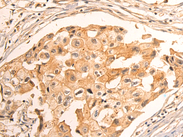 Rabbit Polyclonal Antibody to SLC26A4