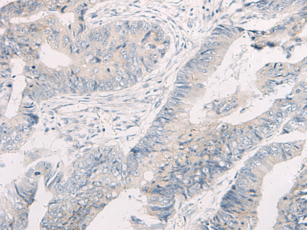 Rabbit Polyclonal Antibody to WNK4