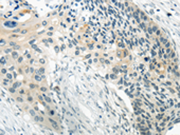 Rabbit Polyclonal Antibody to WNT2B