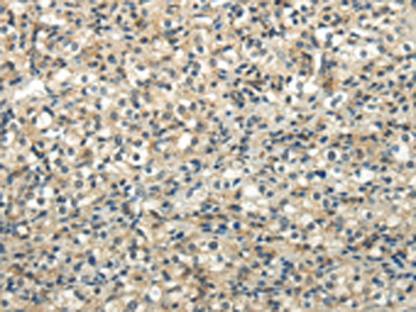 Rabbit Polyclonal Antibody to WNT2
