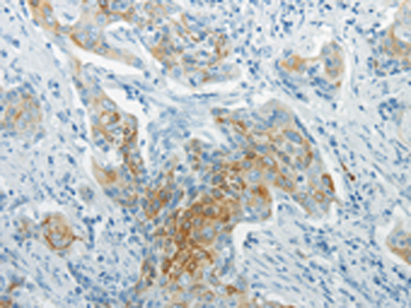 Rabbit Polyclonal Antibody to WNT8B
