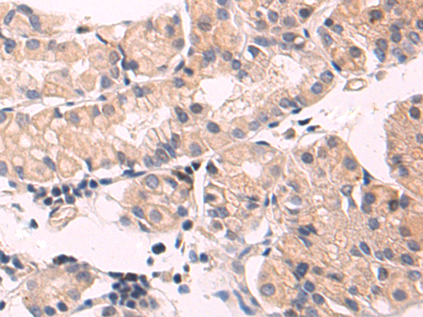 Rabbit Polyclonal Antibody to WNT5B