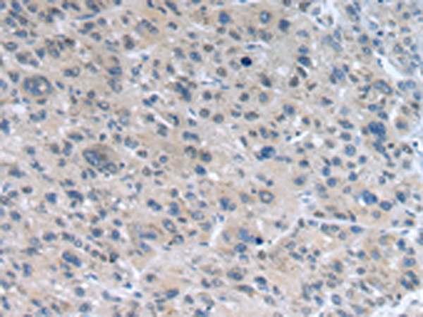Rabbit Polyclonal Antibody to WNT10A